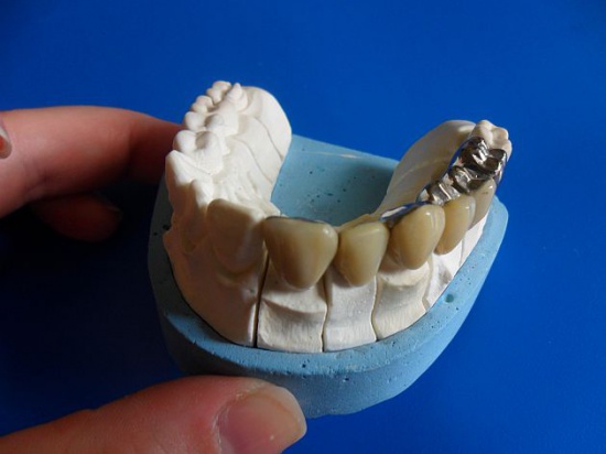 dla uczniów szkolenia unijne, szkoła dentystyczna ZSEN