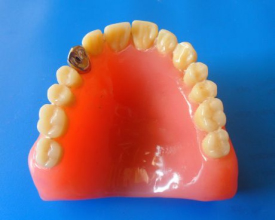 zawód technik dentystyczny